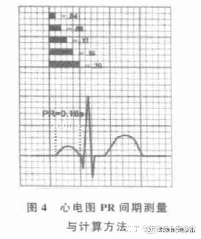 java读取心电图dat文件乱码 心电图文献阅读_QT_06