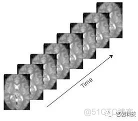 ADNI神经影像数据分析 神经影像技术_ADNI神经影像数据分析_06