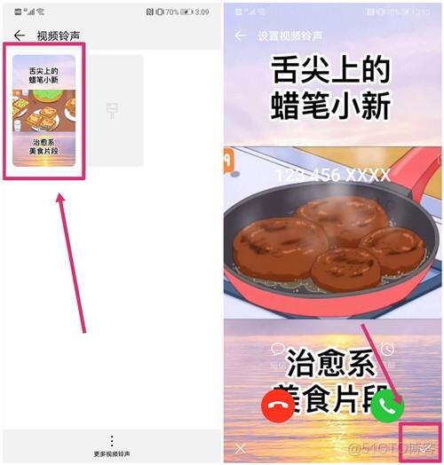 android 视频拨号 拨号视频设置_手机系统_05