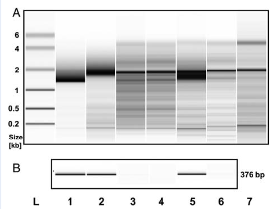 28S:18S rRNA ratio_ide_02