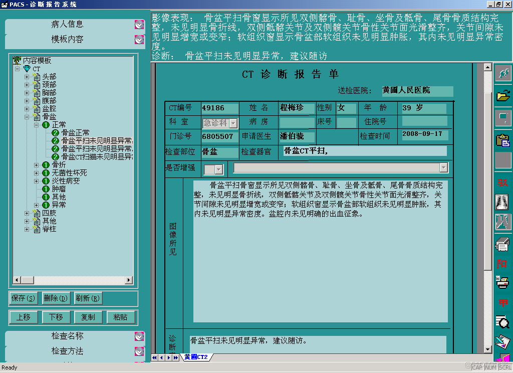 C/S架构的医学影像PACS系统源码_源码_03