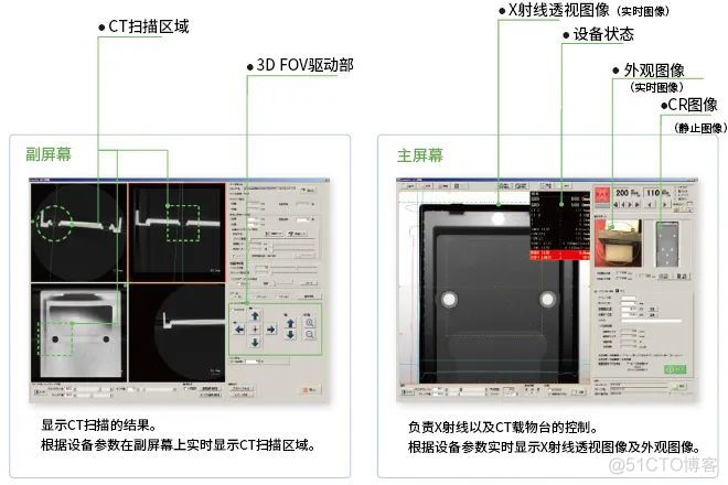 三维重建 python opencv 三维重建ct能查出来什么_三维重建 python opencv_06