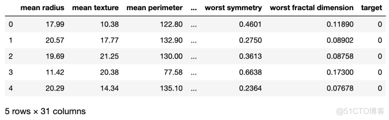 sklearn乳腺癌神经网络 sklearn乳腺癌数据集介绍_sklearn乳腺癌神经网络_02