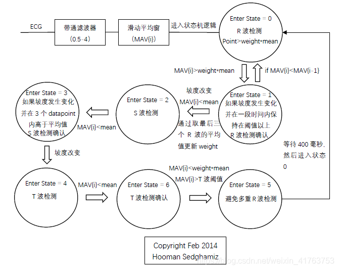 python心电信号处理 心电信号处理实验报告_状态机_07