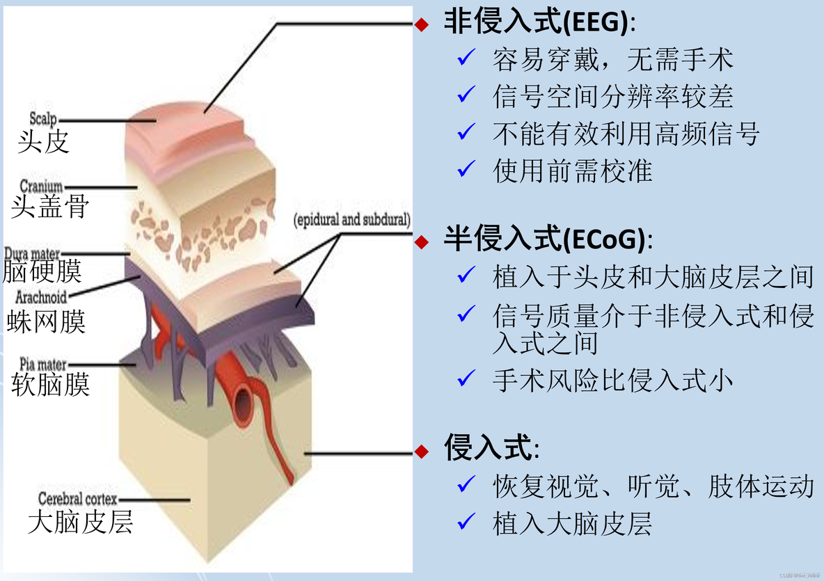 深度学习 脑机接口 脑机接口入门_脑机接口_04