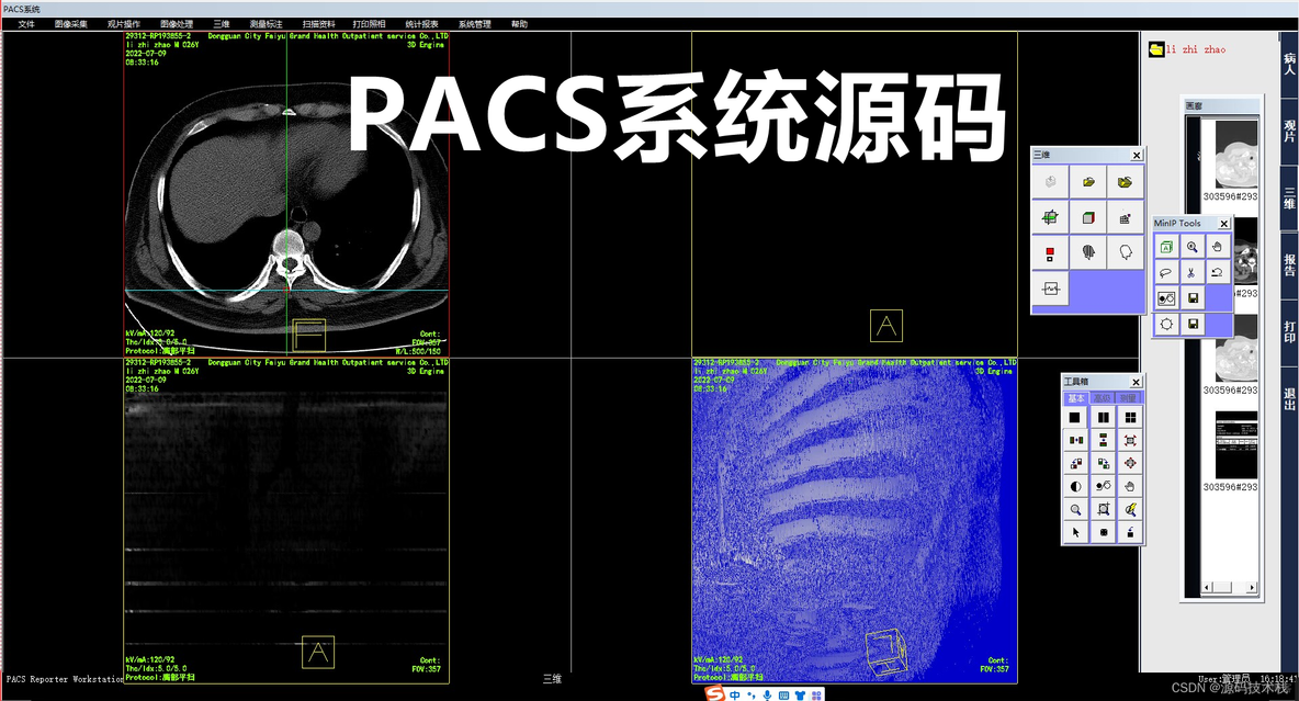 python ct三维重建 pacs 三维重建_c++_02