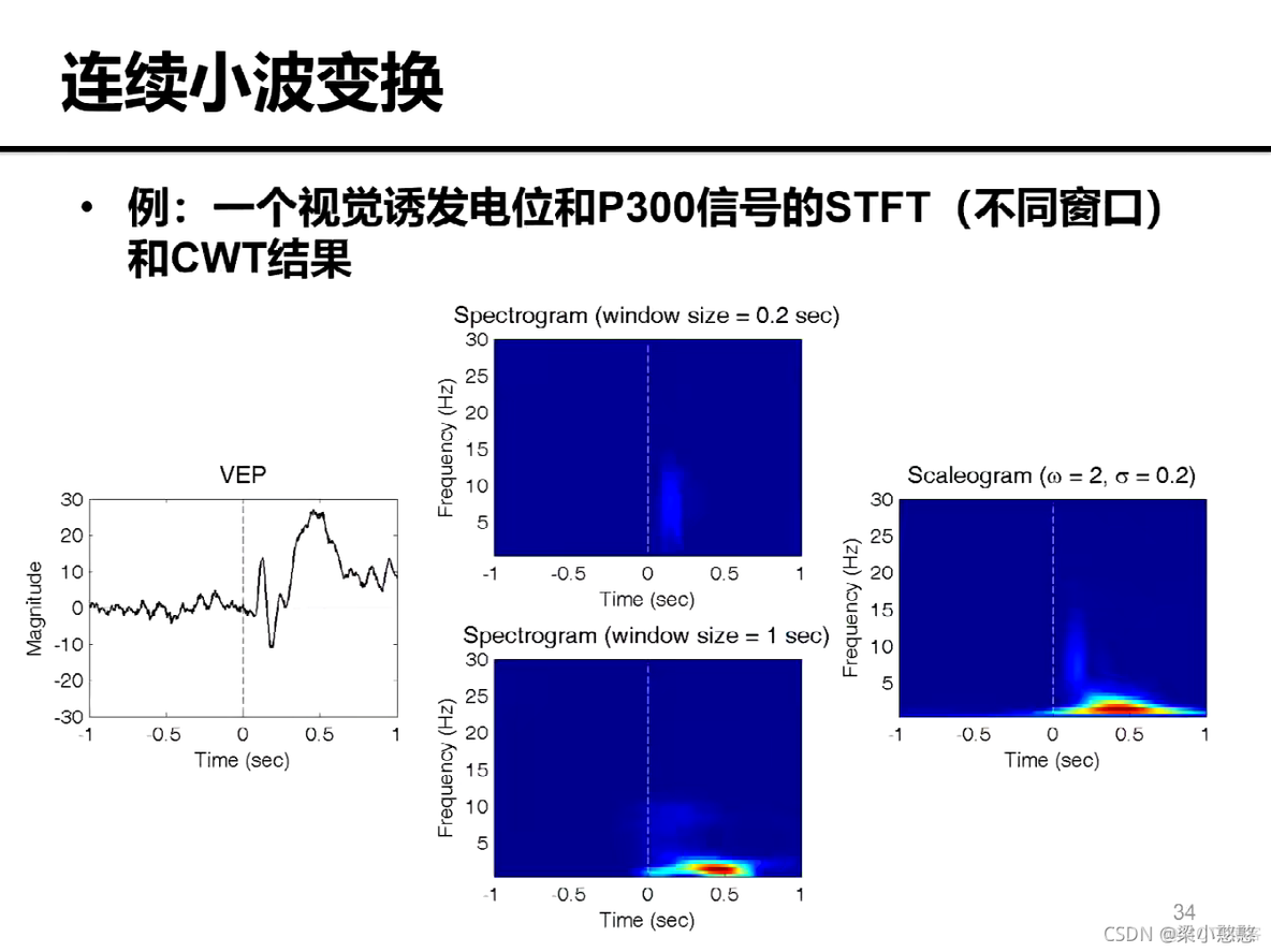 脑电时频图Python 脑电图频谱分析_EEG_32