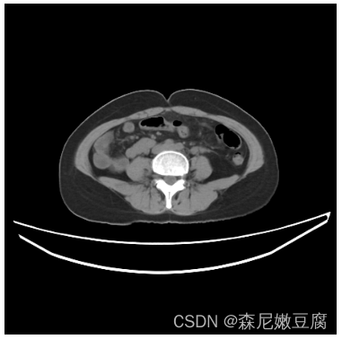 基于Python的npy文件怎么打开 python打开nii文件_重采样_02