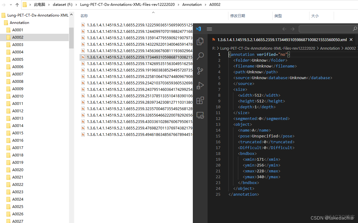 肺癌检测 python 肺癌检测报告图片_目标检测_03