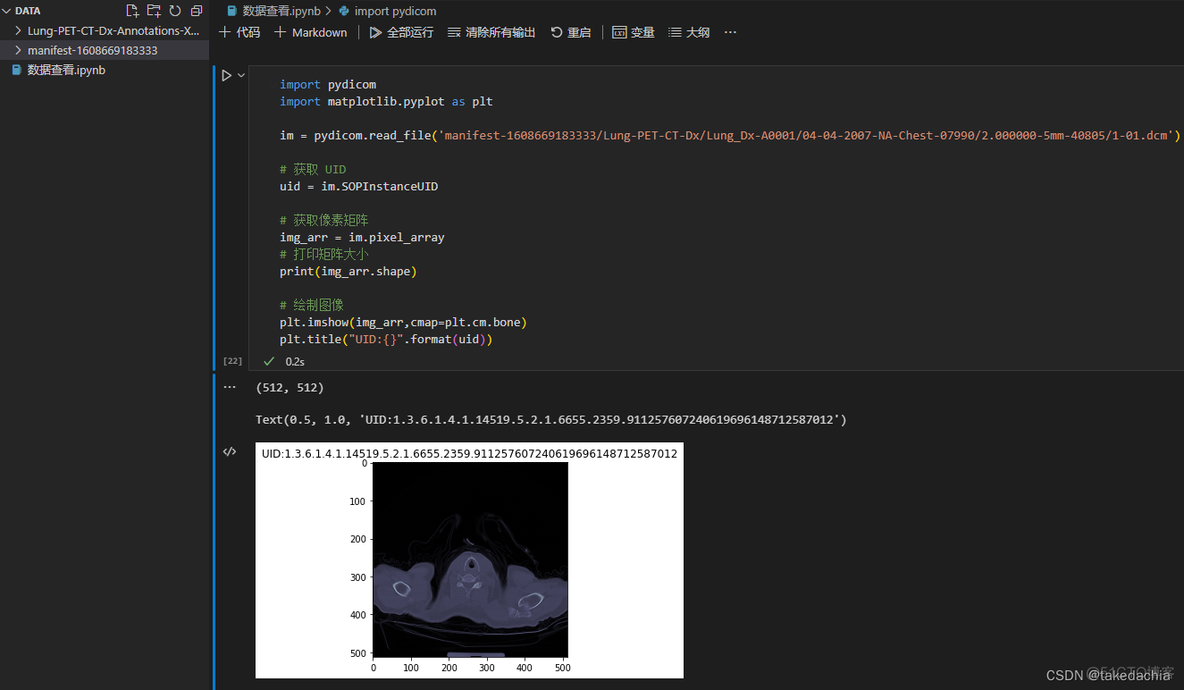 肺癌检测 python 肺癌检测报告图片_人工智能_05