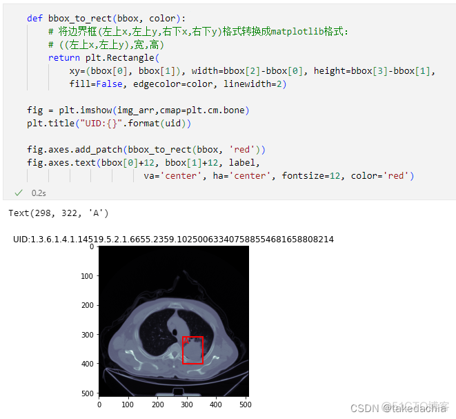 肺癌检测 python 肺癌检测报告图片_人工智能_09