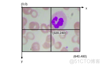 血细胞图片分类系统python 血细胞图文检查 是什么_神经网络_18