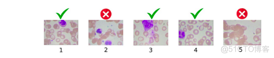 血细胞图片分类系统python 血细胞图文检查 是什么_机器学习_22
