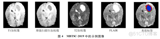 神经网络分割支气管实例 神经网络图像分割算法_机器学习_13