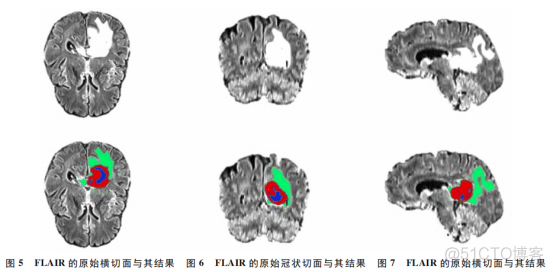 神经网络分割支气管实例 神经网络图像分割算法_机器学习_14