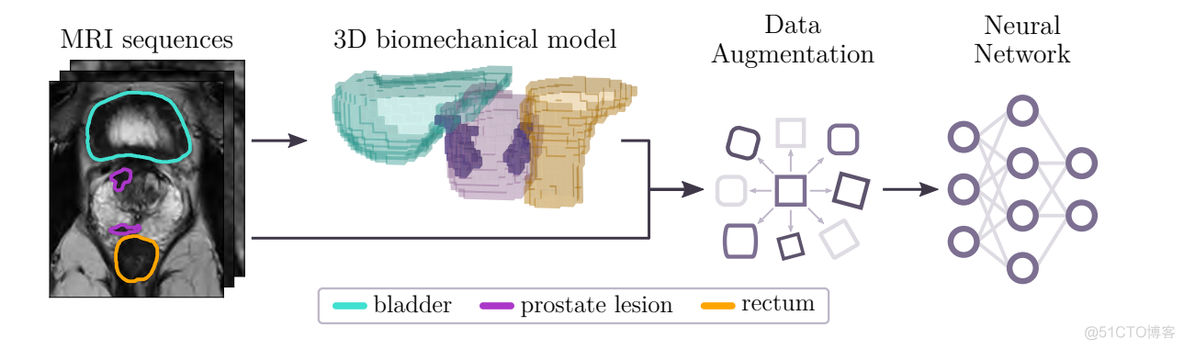 【前列腺数据增强】基于解剖学的变形方法_数据集_03
