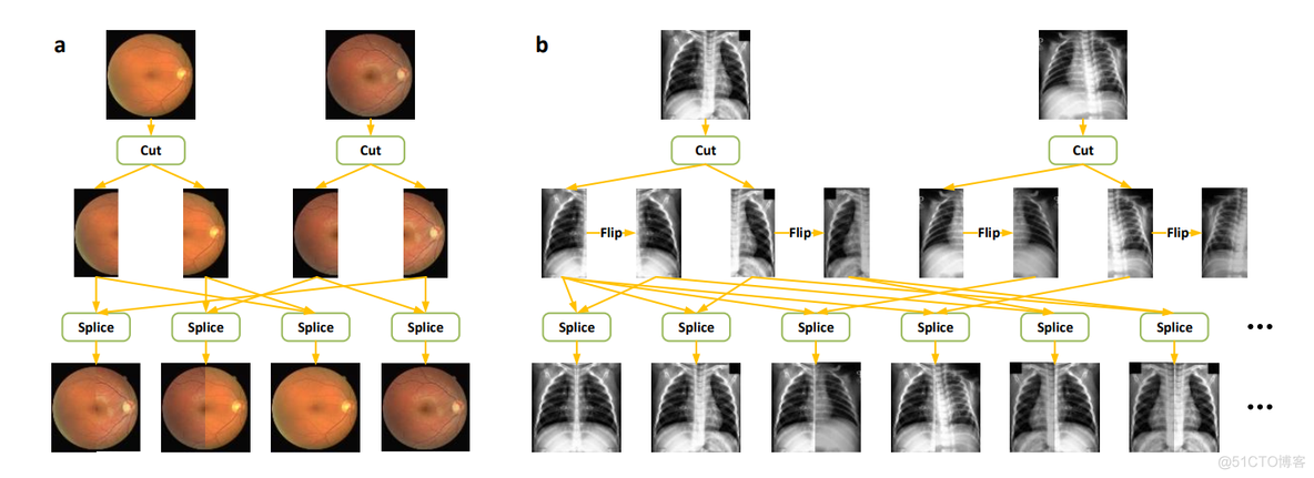 【医学图像数据增强】切割-拼接(CS-DA)_人工智能_03