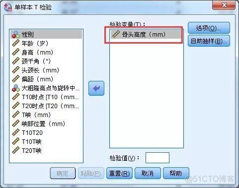 R语言配对样本t检验图表 r语言t检验结果解读_方差分析_03