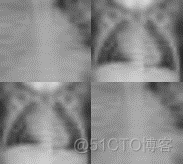 医学图像分类常用数据集 医学图像分类模型_人工智能