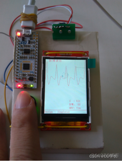 基于antdesign 基于stm32的毕业设计_单片机_02