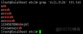 grep 正则匹配内容存入变量 grep 匹配正则表达式_锚定_12