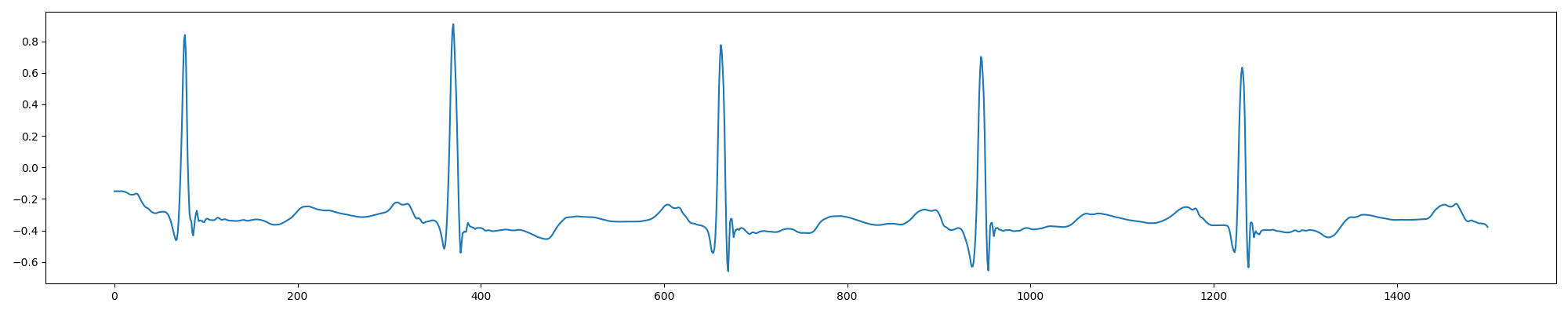 python用CNN处理心音信号程序 python处理心电信号_tensorflow_11