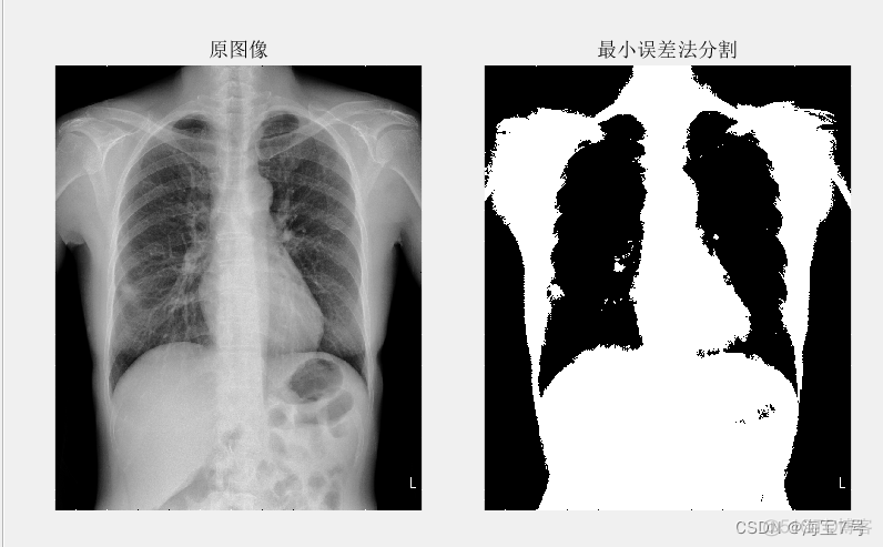 最小误差阈值分割和最大类间方差阈值分割python 最小误差阈值原理步骤_像素点_04