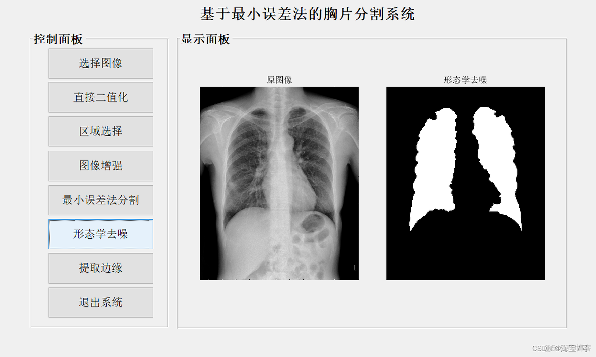 最小误差阈值分割和最大类间方差阈值分割python 最小误差阈值原理步骤_算法_08