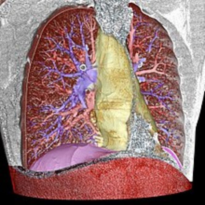 计算机视觉基础八股文 计算机视觉基础及应用_大数据_03