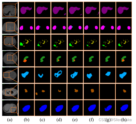 NET_SCH_NETEM 模块 net segment_肿瘤分割_14