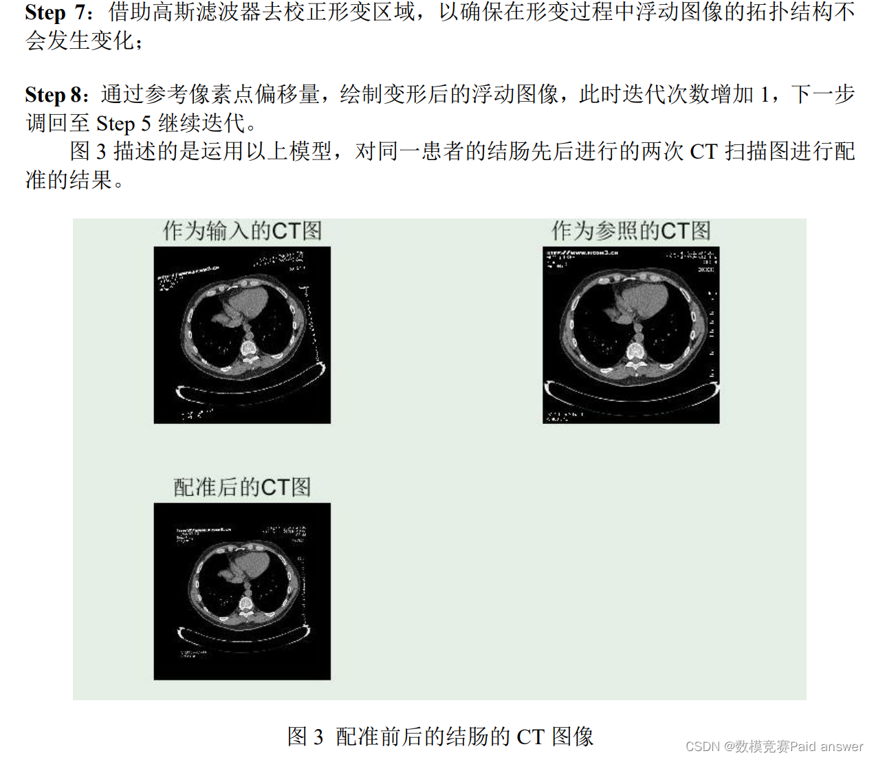 医学图像配准 刚体变换配准和仿射变换 python 医学图像配准建模_算法_09