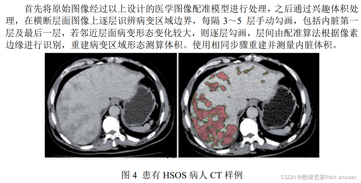 医学图像配准 刚体变换配准和仿射变换 python 医学图像配准建模_算法_10