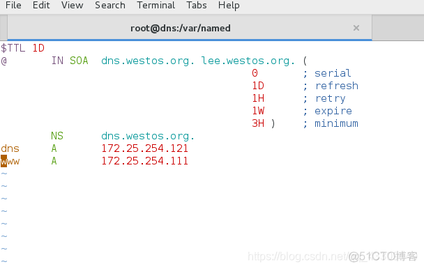 centos 正反向解析声明文件写不正确 dns会开启不了吗_DNS_04