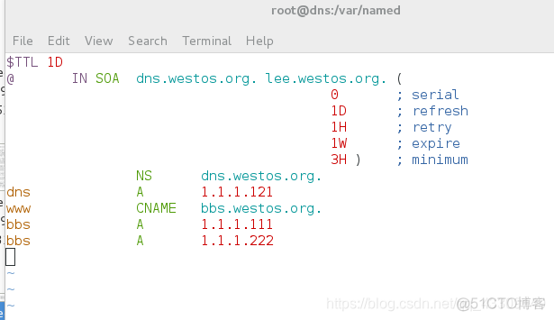 centos 正反向解析声明文件写不正确 dns会开启不了吗_DNS_18