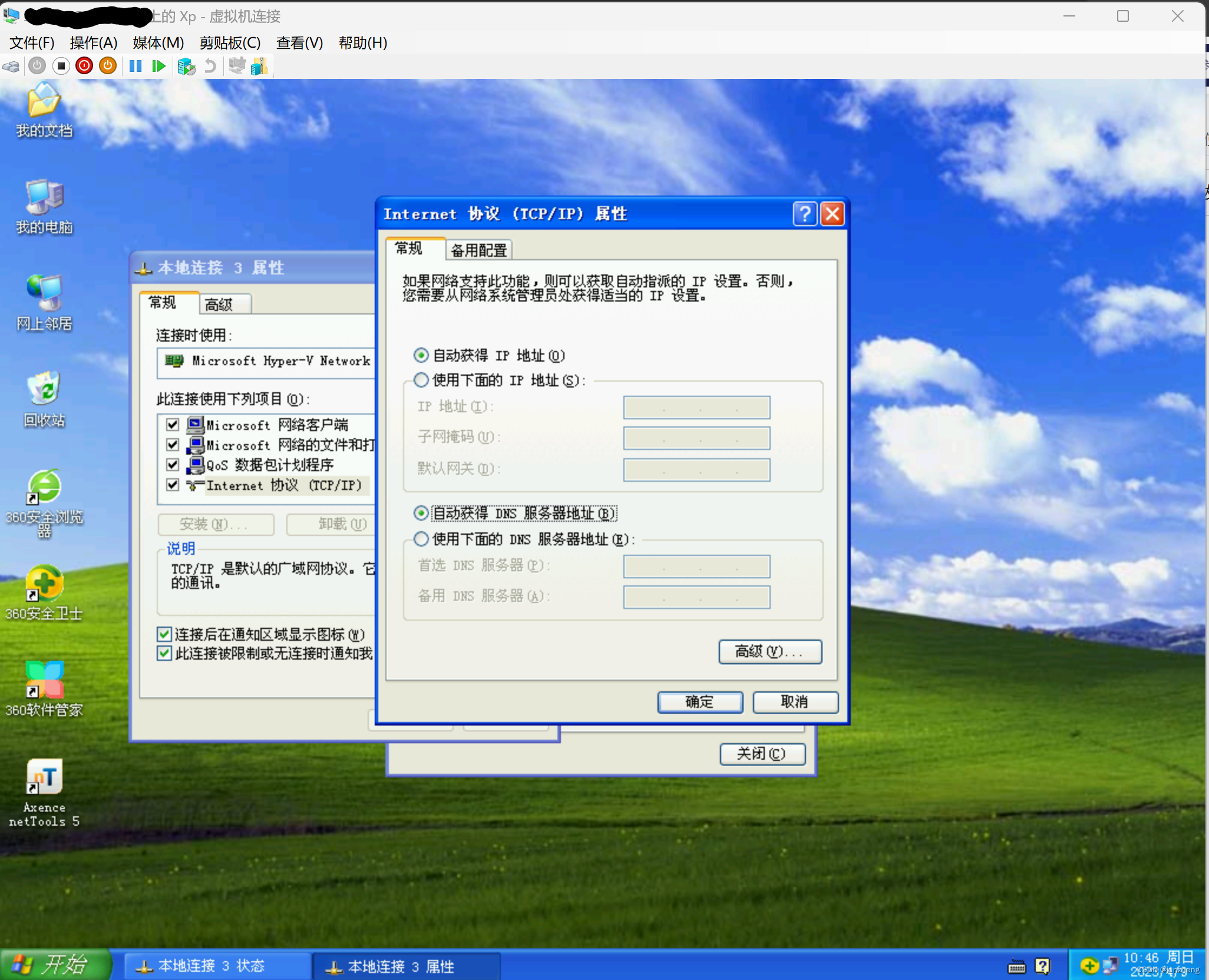 hyper centos 虚拟机 网络不通_Windows_07