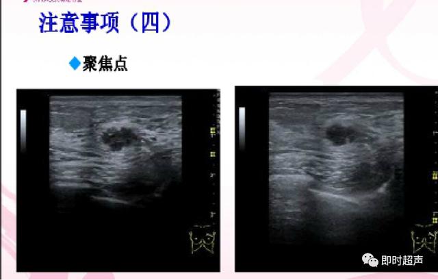 深度学习超声信号降噪滤波_图像显示_04