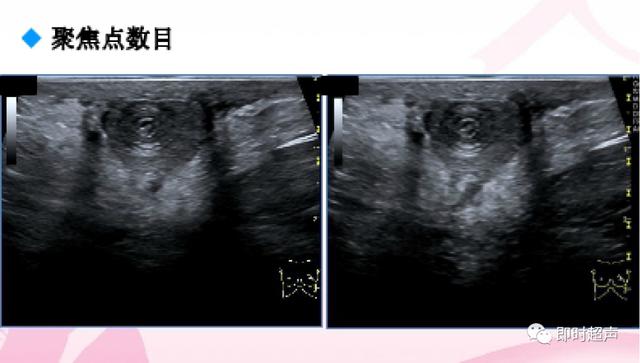 深度学习超声信号降噪滤波_labelimg如何调整框的颜色_05