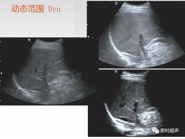 深度学习超声信号降噪滤波_labelimg如何调整框的颜色_11