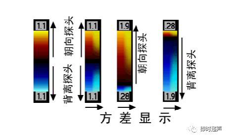 深度学习超声信号降噪滤波_图像显示_12