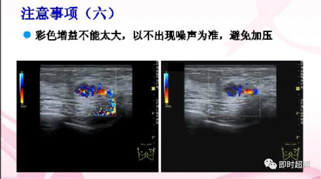 深度学习超声信号降噪滤波_图像显示_14