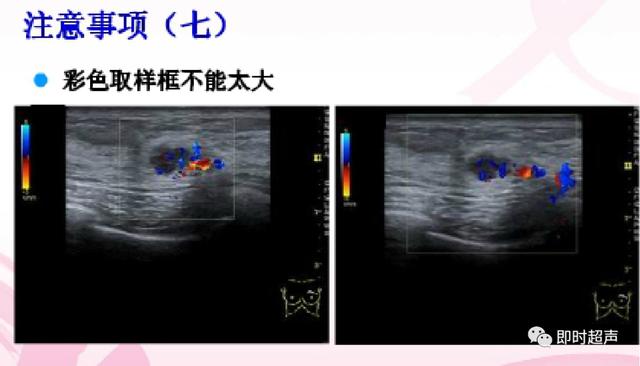 深度学习超声信号降噪滤波_图像显示_15