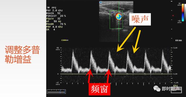 深度学习超声信号降噪滤波_二维_16