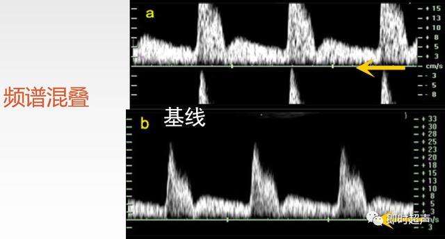 深度学习超声信号降噪滤波_二维_17