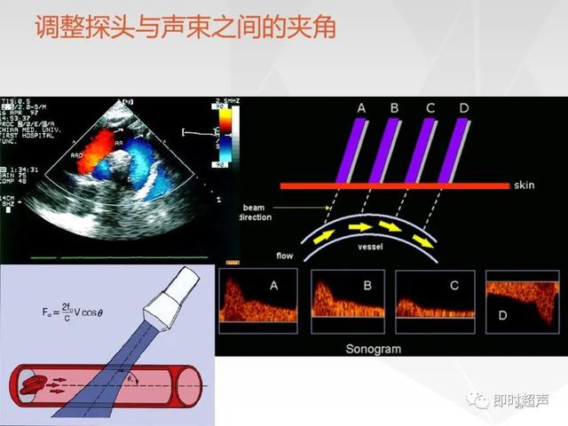 深度学习超声信号降噪滤波_基线_18