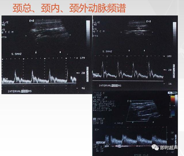 深度学习超声信号降噪滤波_图像显示_27