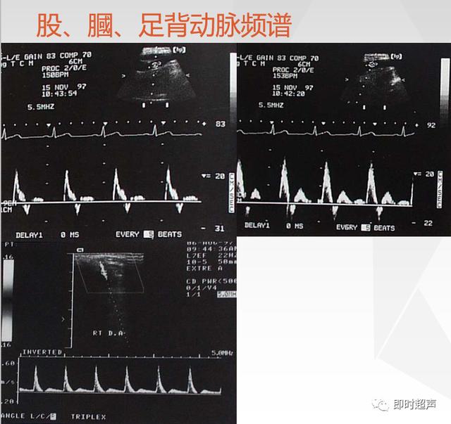 深度学习超声信号降噪滤波_labelimg如何调整框的颜色_28