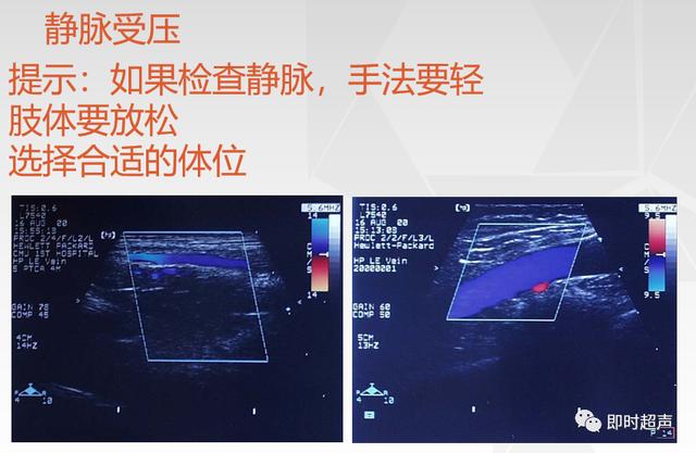 深度学习超声信号降噪滤波_深度学习超声信号降噪滤波_29