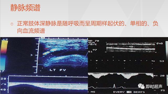 深度学习超声信号降噪滤波_labelimg如何调整框的颜色_30