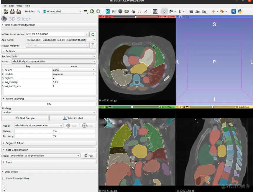 在3D Slicer中使用 Monai Bundle 和 Model Zoo 标注医学影像数据-全身CT器官分割_bundle