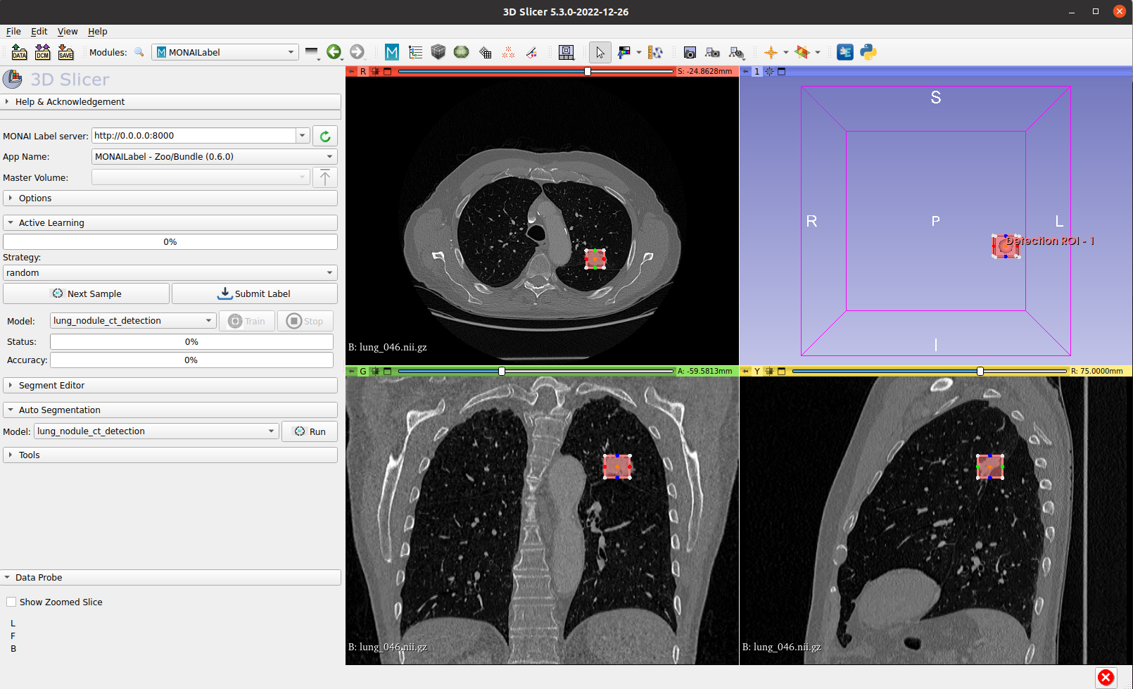 在3D Slicer中使用 Monai Bundle 和 Model Zoo 标注医学影像数据-CT肺结节检测_人工智能